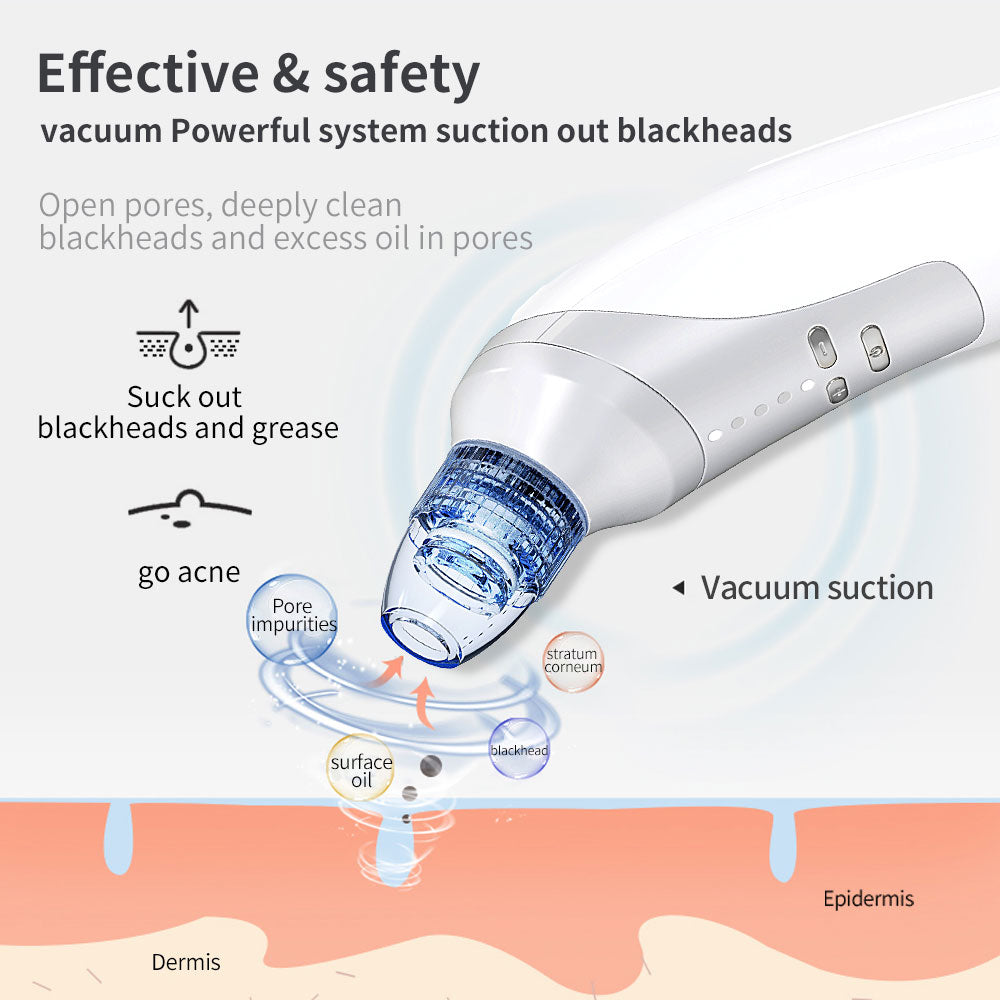 Electric Blackhead Remover Vacuum – Powerful Pore Suction Device for Blackheads, Acne & Deep Facial Cleansing