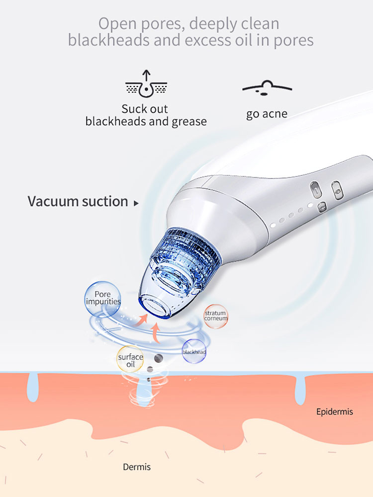 Electric Blackhead Remover Vacuum – Powerful Pore Suction Device for Blackheads, Acne & Deep Facial Cleansing